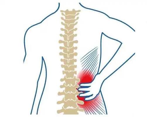 Soulager un lumbago naturellement