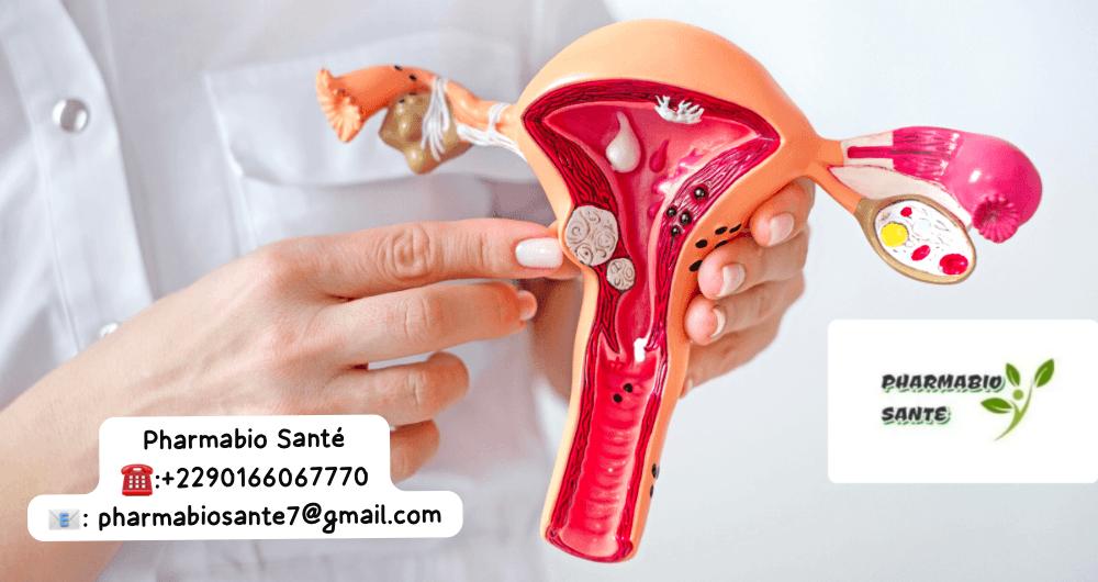 Myomes fibromes solution naturelle