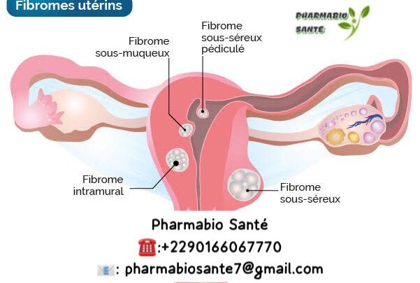 Fibrome et Grossesse