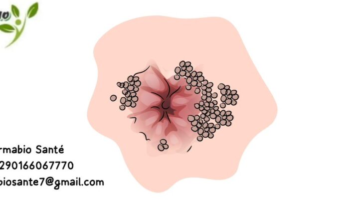 Traitement naturel condylome