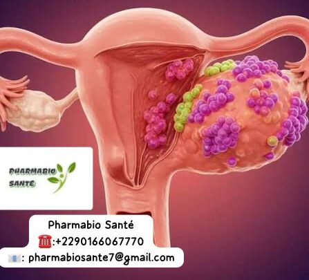 Alimentation Kystes Ovariens