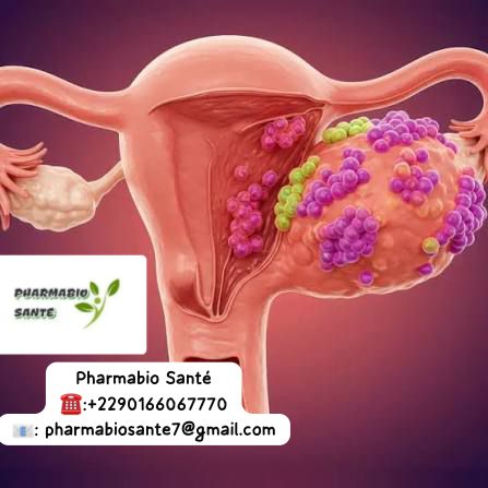 Alimentation Kystes Ovariens