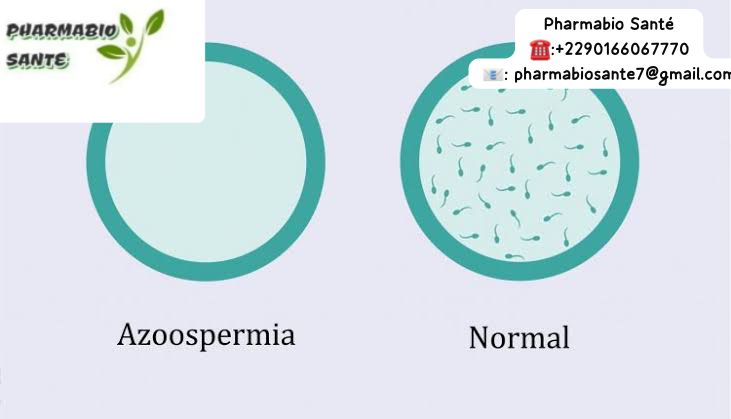 Solution naturelle pour soigner l'azoospermie