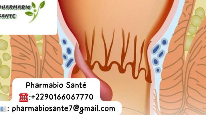 Condylome anal vaginal pénien