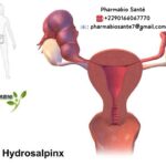 Hydrosalpinx Solutions Naturelles