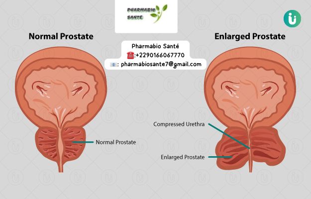 Prostate Solutions Naturelles Plantes